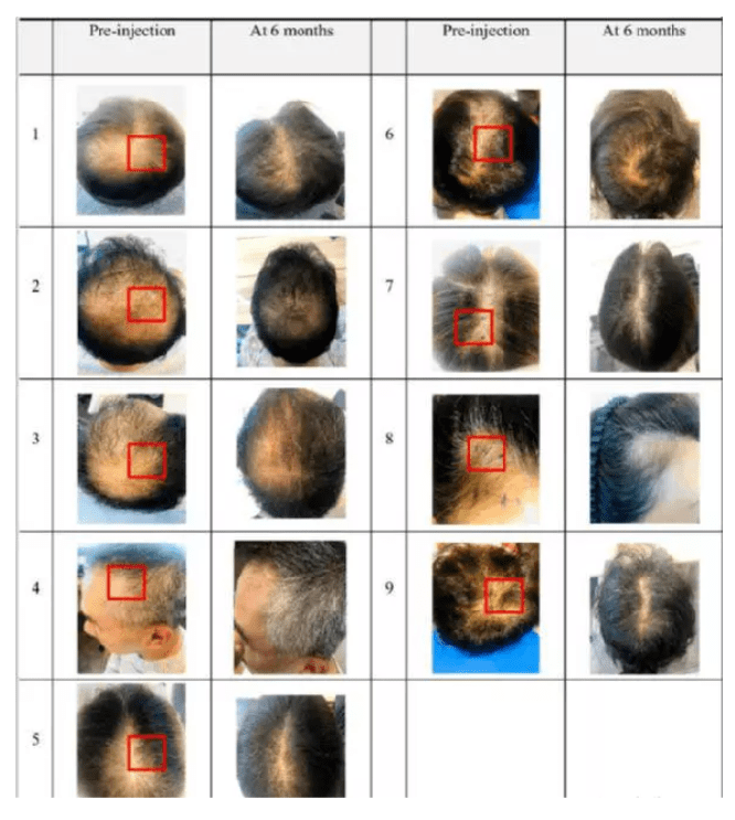 1661734818101223.png image.png