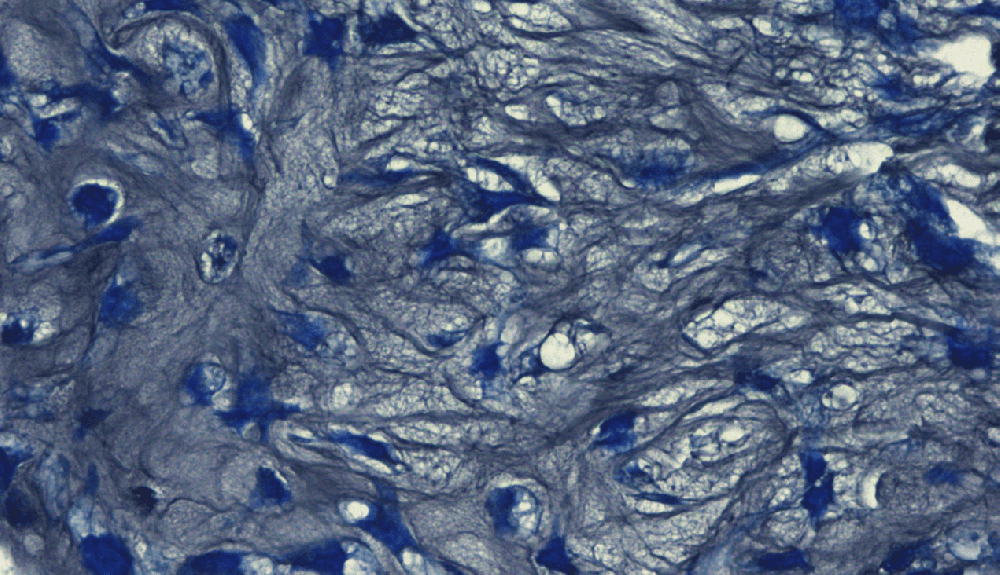 間充質(zhì)干細胞有提高免疫的作用嗎？