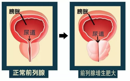 1667195851170223.png 1667195849225.png