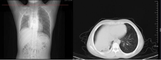 1673058127790694.jpg 42241672278658566.jpg