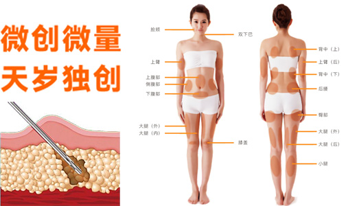 1675922295342018.jpg zhifangcaiji.jpg