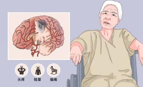 1692947193693974.jpg naocuzhong.jpg