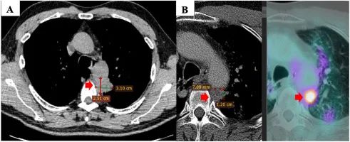 1698047757241911.jpg 640.jpg