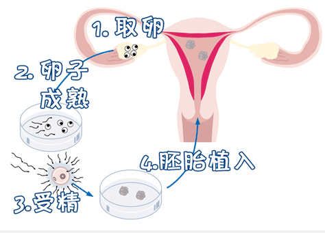 1699932589124560.png 640 (2).png