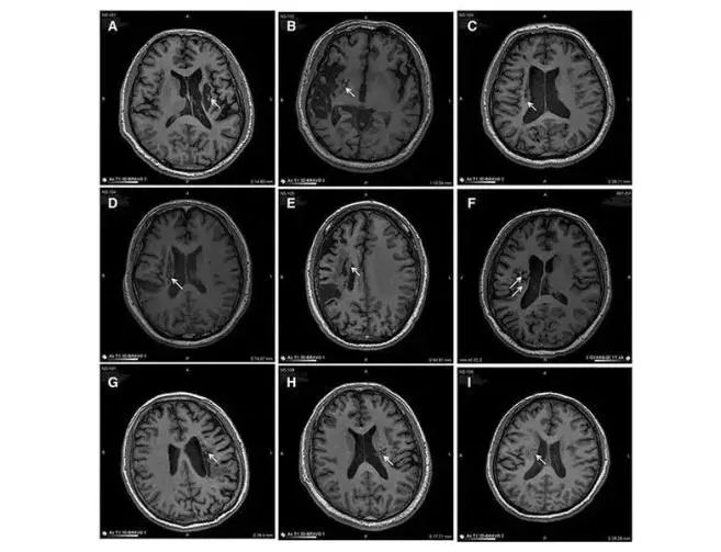 1726287514147194.jpg 微信圖片_20240913170930.jpg